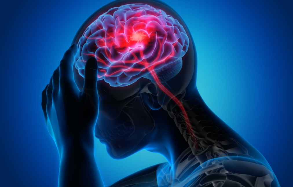 animación de lesión cerebral