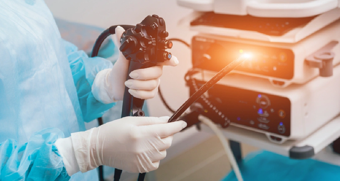 médico sosteniendo endoscopio