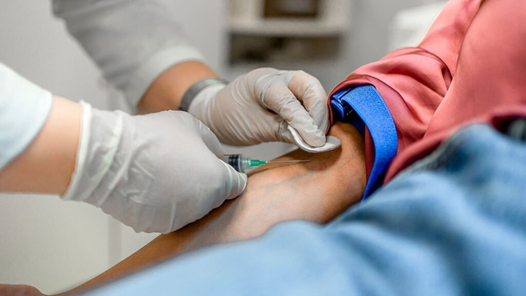 ¿Cómo saber si tengo anemia?