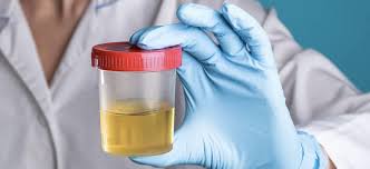 personal de salud con prueba de orina