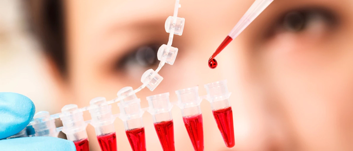 especialista analizando sangre
