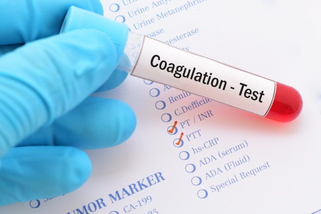 tubo de sangre para test de coagulación