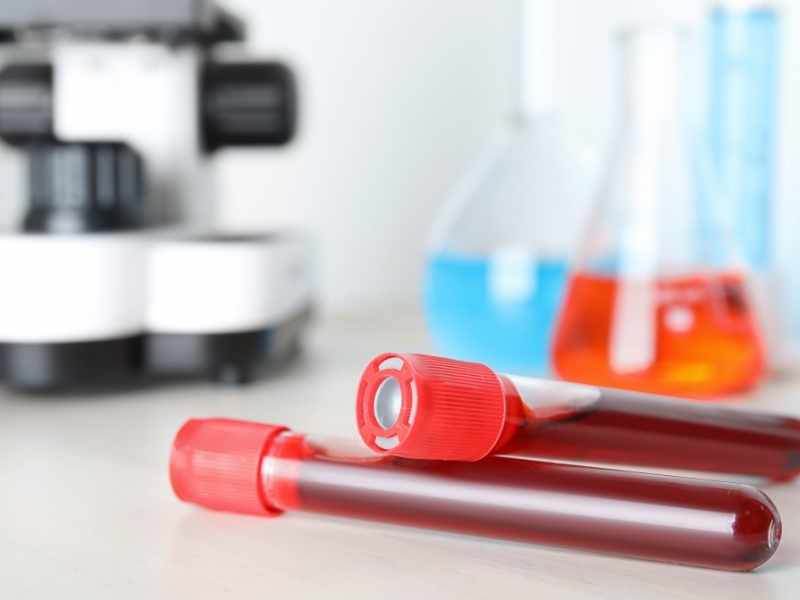 Mesa limpia con tubos de laboratorio, orden médica y calendario discreto, estilo profesional, sin sangre visible.