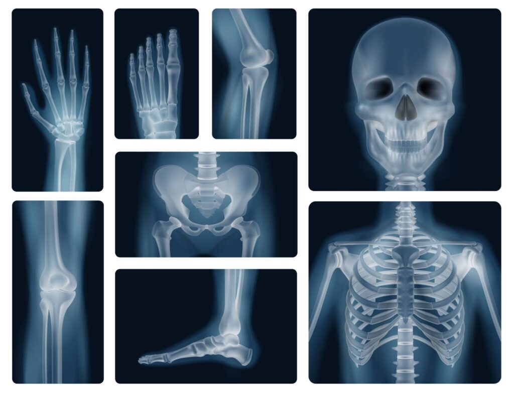Radiografías de distintas partes del cuerpo