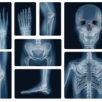 Radiografías de distintas partes del cuerpo